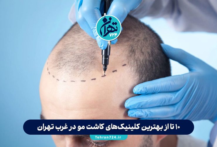 10 تا از بهترین کلینیک‌های کاشت مو در غرب تهران + آدرس، شماره تماس و خدمات (آپدیت 1405)