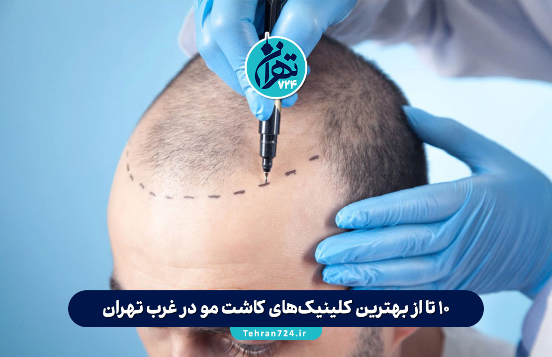 10 تا از بهترین کلینیک‌های کاشت مو در غرب تهران + آدرس، شماره تماس و خدمات (آپدیت 1405)