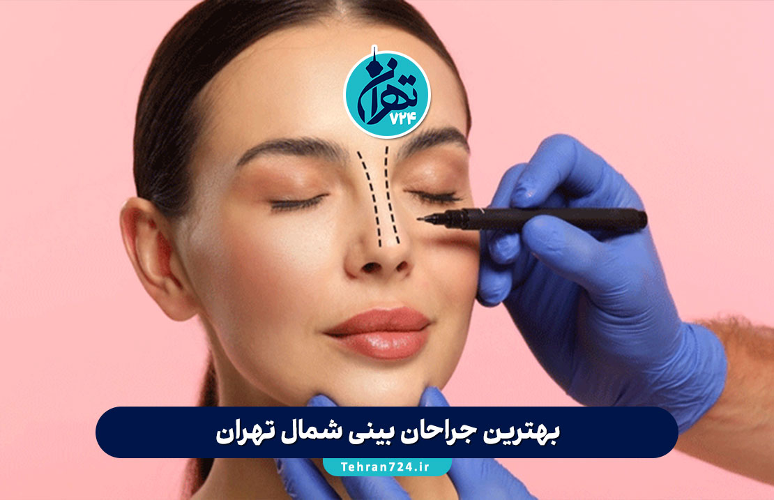 بهترین جراحان بینی شمال تهران 1405 | لیست پزشکان معتبر، آدرس و تجربه بیماران