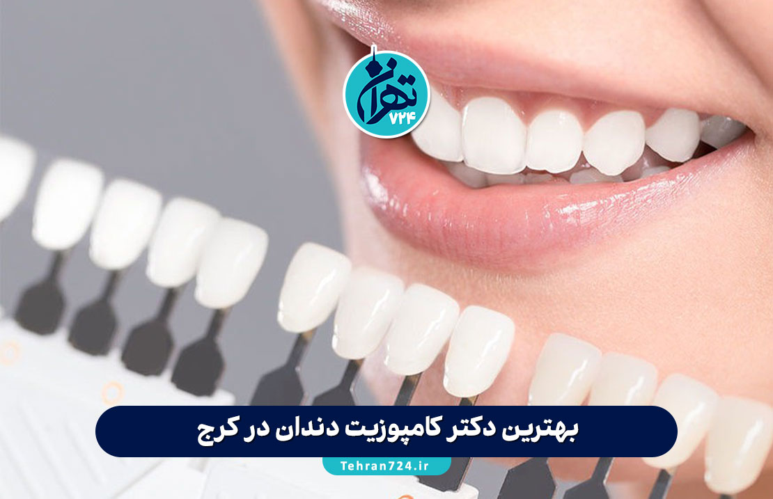 بهترین دکتر کامپوزیت دندان در کرج | معرفی ۷ متخصص برتر + نکات و تجربه درمان موفق