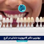 بهترین دکتر کامپوزیت دندان در کرج | معرفی متخصصین، مزایا و راهنمای کامل انتخاب