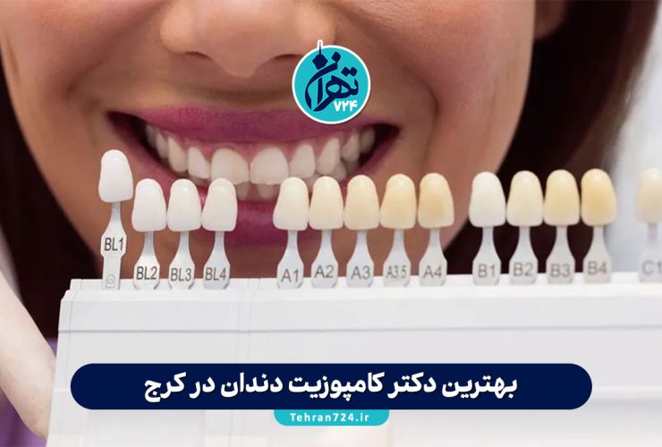 بهترین دکتر کامپوزیت دندان در کرج | معرفی متخصصین، مزایا و راهنمای کامل انتخاب