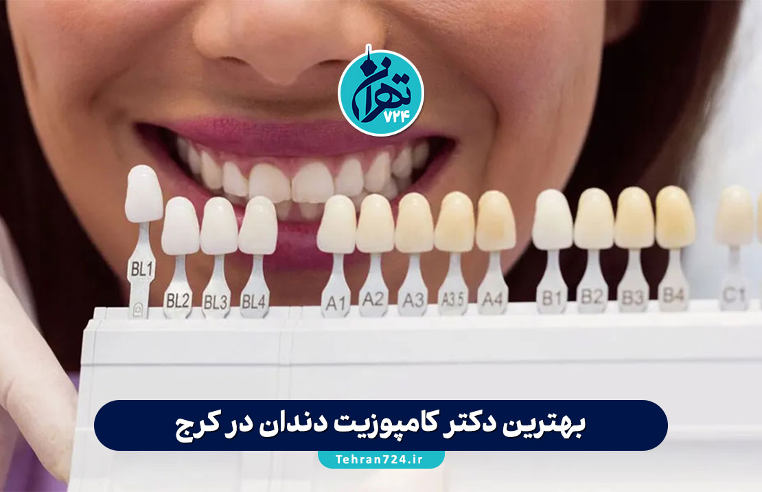 بهترین دکتر کامپوزیت دندان در کرج | معرفی متخصصین، مزایا و راهنمای کامل انتخاب