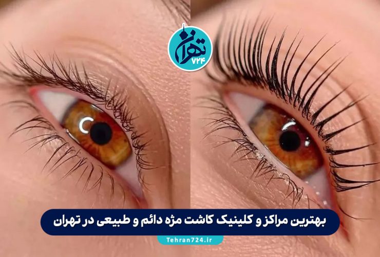 بهترین مراکز و کلینیک کاشت مژه دائم و طبیعی در تهران + آدرس و شماره تماس 1405 بهترین مراکز و کلینیک کاشت مژه دائم و طبیعی در تهران + آدرس و شماره تماس 1405