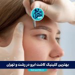 بهترین کلینیک‌ کاشت ابرو در رشت و تهران + آدرس، شماره تماس و قیمت 1405