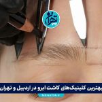 بهترین کلینیک‌های کاشت ابرو در اردبیل و تهران | معرفی 11 مرکز معتبر با آدرس و خدمات 2025