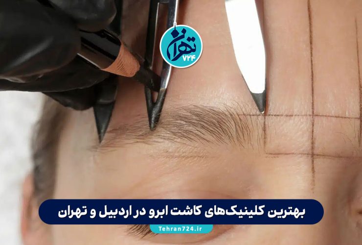 بهترین کلینیک‌های کاشت ابرو در اردبیل و تهران | معرفی 11 مرکز معتبر با آدرس و خدمات 2025