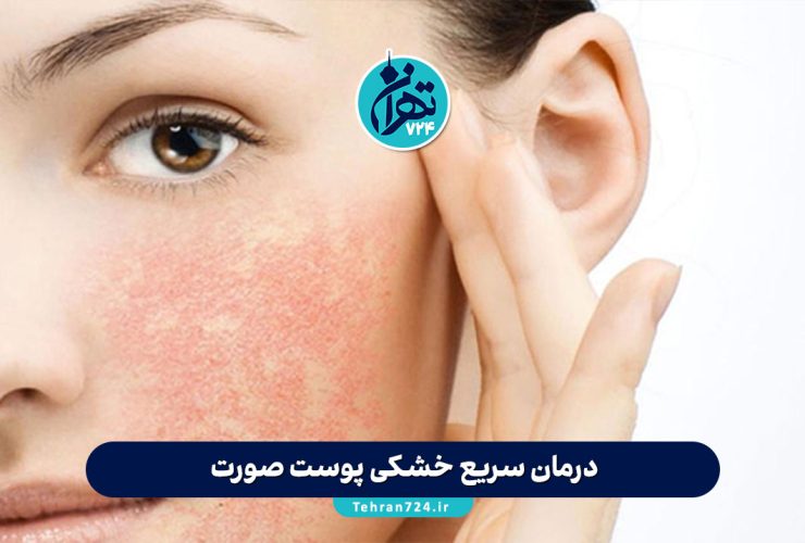 درمان سریع خشکی پوست صورت: ۷ راهکار ساده و موثر برای آبرسانی و نرمی فوری پوست درمان سریع خشکی پوست صورت: ۷ راهکار ساده و موثر برای آبرسانی و نرمی فوری پوست