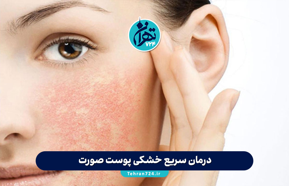 درمان سریع خشکی پوست صورت: ۷ راهکار ساده و موثر برای آبرسانی و نرمی فوری پوست