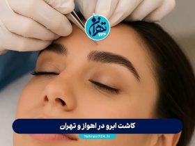 کاشت ابرو در اهواز و تهران | معرفی بهترین کلینیک‌ها با آدرس، روش‌ها و هزینه 1405
