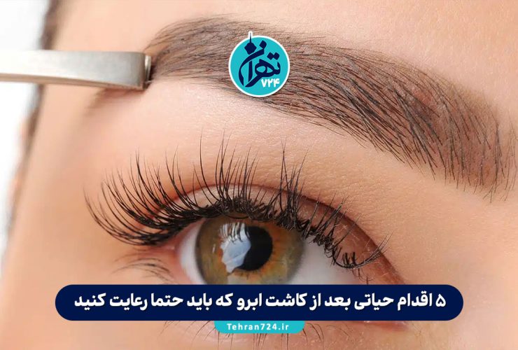 ۵ اقدام حیاتی بعد از کاشت ابرو که باید حتما رعایت کنید (راهنمای کامل مراقبت‌های بعد از کاشت ابرو)