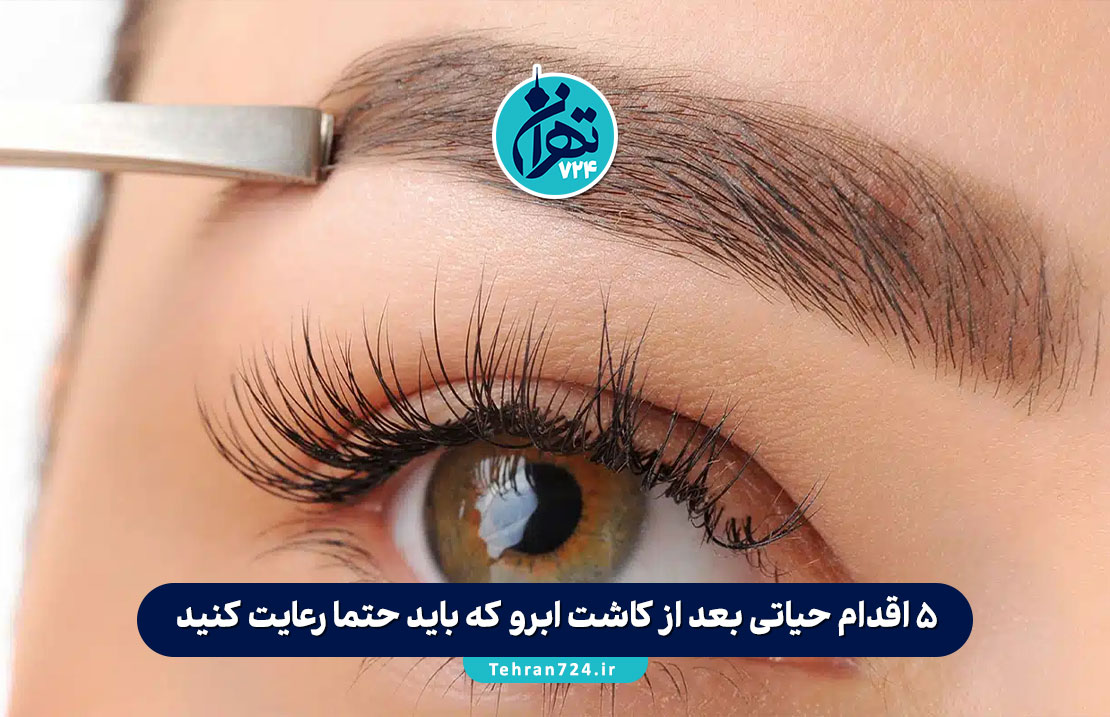 ۵ اقدام حیاتی بعد از کاشت ابرو که باید حتما رعایت کنید (راهنمای کامل مراقبتهای بعد از کاشت ابرو) ۵ اقدام حیاتی بعد از کاشت ابرو که باید حتما رعایت کنید (راهنمای کامل مراقبتهای بعد از کاشت ابرو)