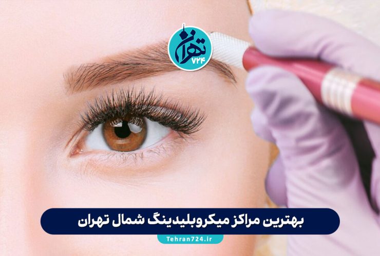 بهترین مراکز میکروبلیدینگ شمال تهران | لیست ۴ سالن برتر با آدرس و قیمت 1405 بهترین مراکز میکروبلیدینگ شمال تهران | لیست ۴ سالن برتر با آدرس و قیمت 1405