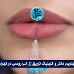 بهترین دکتر و کلینیک تزریق ژل لب روسی در تهران + شماره تماس و آدرس ۱۴۰۳