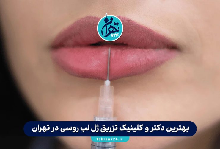 بهترین دکتر و کلینیک تزریق ژل لب روسی در تهران + شماره تماس و آدرس ۱۴۰۳
