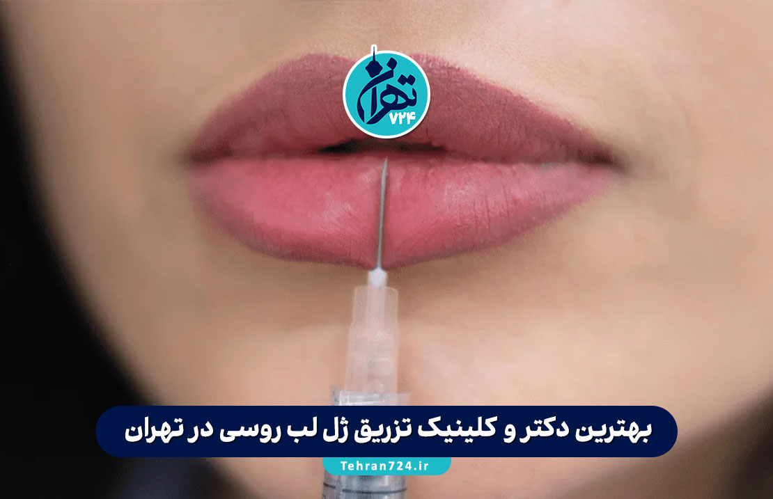 بهترین دکتر و کلینیک تزریق ژل لب روسی در تهران + شماره تماس و آدرس ۱۴۰۳