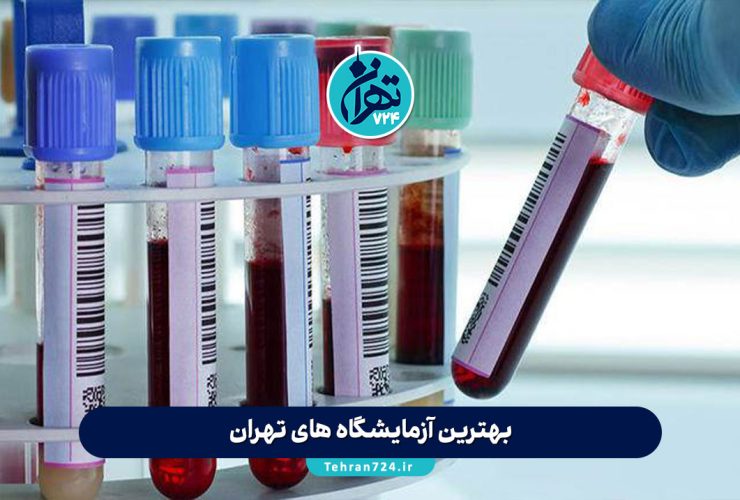 بهترین آزمایشگاه های تهران 1405 | لیست ۱۰ مرکز معتبر برای آزمایش پزشکی با آدرس و خدمات