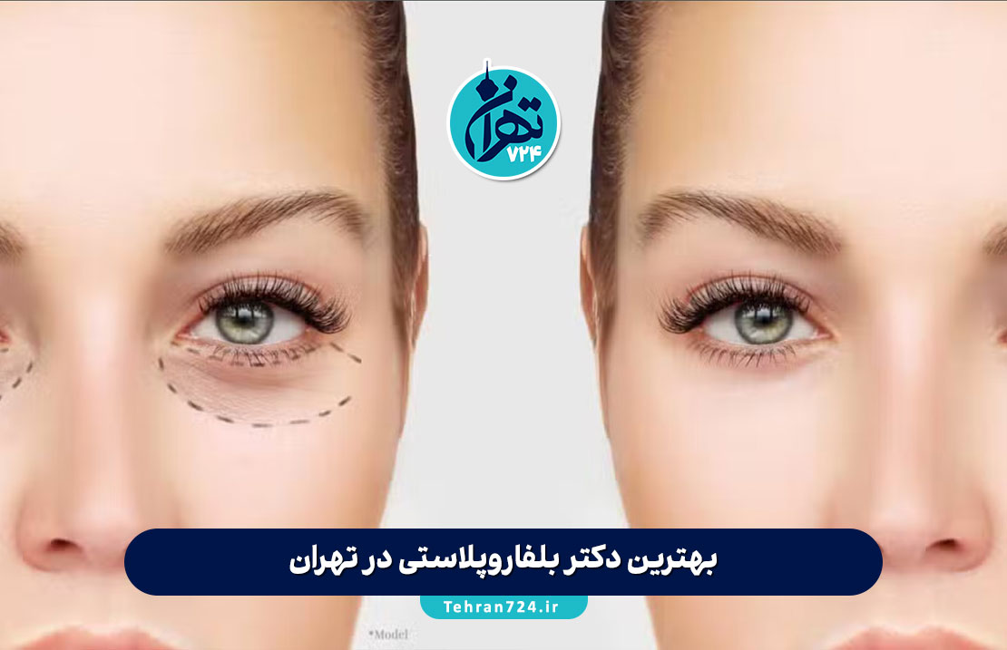 بهترین دکتر بلفاروپلاستی در تهران | لیست ۱۰ جراح برتر پلک با آدرس و شماره تماس 1405