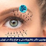 بهترین دکتر بلفاروپلاستی و جراح پلک در تهران | معرفی 10 فوق تخصص برتر 1405