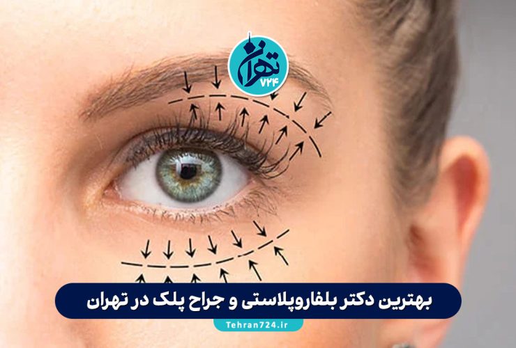 بهترین دکتر بلفاروپلاستی و جراح پلک در تهران | معرفی 10 فوق تخصص برتر 1405