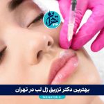بهترین دکتر تزریق ژل لب در تهران 1405 | لیست ۹ مرکز برتر با آدرس و مشاوره رایگان