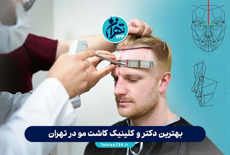بهترین دکتر و کلینیک کاشت مو در تهران 1405 + لیست مراکز معتبر و آدرس