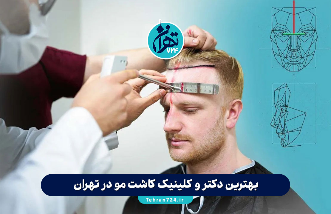 بهترین دکتر و کلینیک کاشت مو در تهران 1405 + لیست مراکز معتبر و آدرس