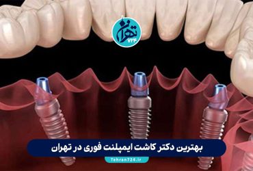 بهترین دکتر کاشت ایمپلنت فوری در تهران | معرفی 8 متخصص برتر + آدرس و شماره تماس