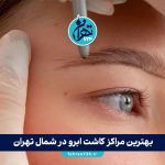 بهترین مراکز کاشت ابرو در شمال تهران | معرفی 9 کلینیک تخصصی با آدرس و قیمت 1405