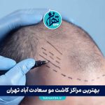 بهترین مراکز کاشت مو سعادت آباد تهران | لیست 8 کلینیک تخصصی با آدرس و خدمات 2025