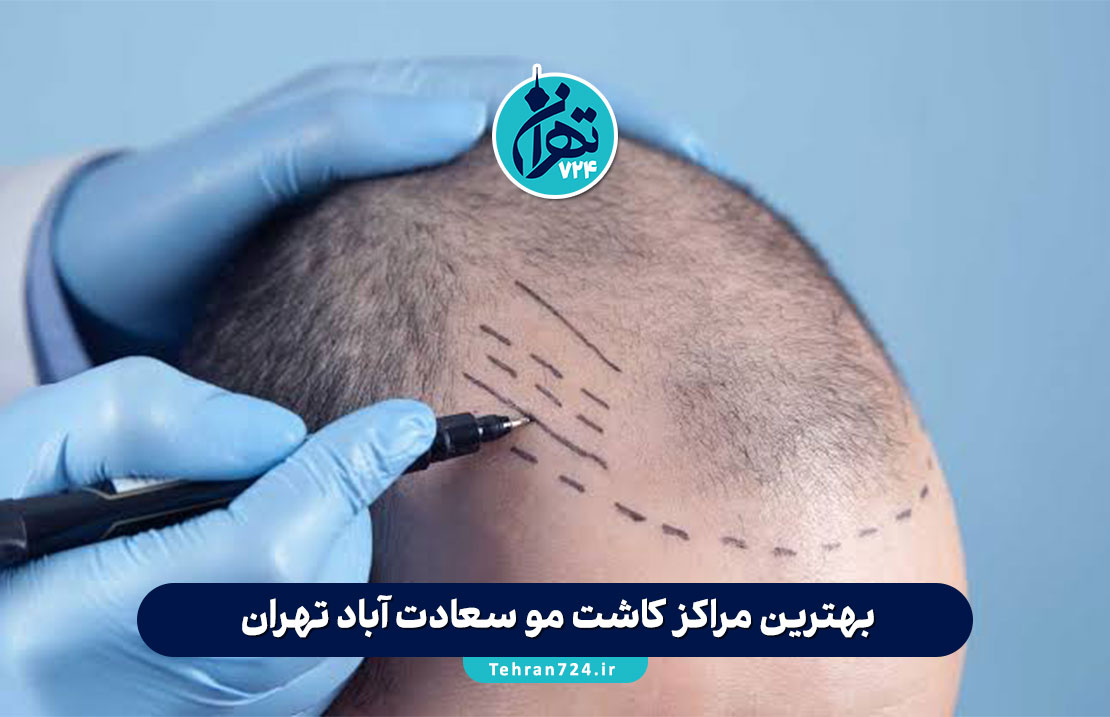 بهترین مراکز کاشت مو سعادت آباد تهران | لیست 8 کلینیک تخصصی با آدرس و خدمات 2025