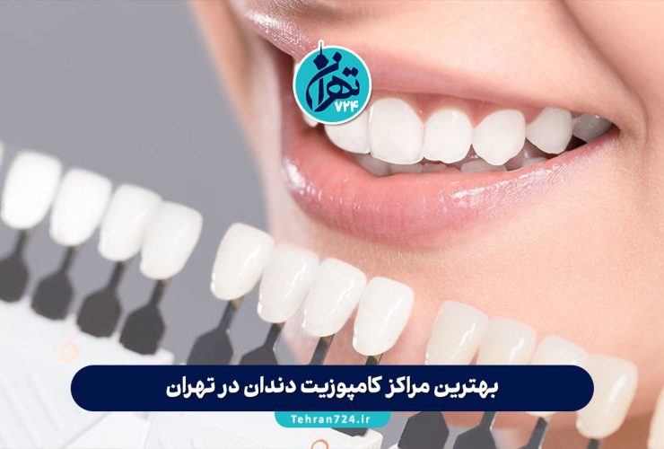 بهترین مراکز کامپوزیت دندان در تهران 1405 + معرفی 12 کلینیک و دکتر برتر کامپوزیت تهران