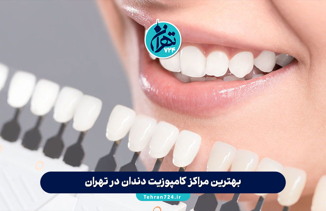 بهترین مراکز کامپوزیت دندان در تهران 1405 + معرفی 12 کلینیک و دکتر برتر کامپوزیت تهران