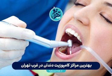 بهترین مراکز کامپوزیت دندان در غرب تهران | معرفی ۵ کلینیک برتر با آدرس و شماره تماس