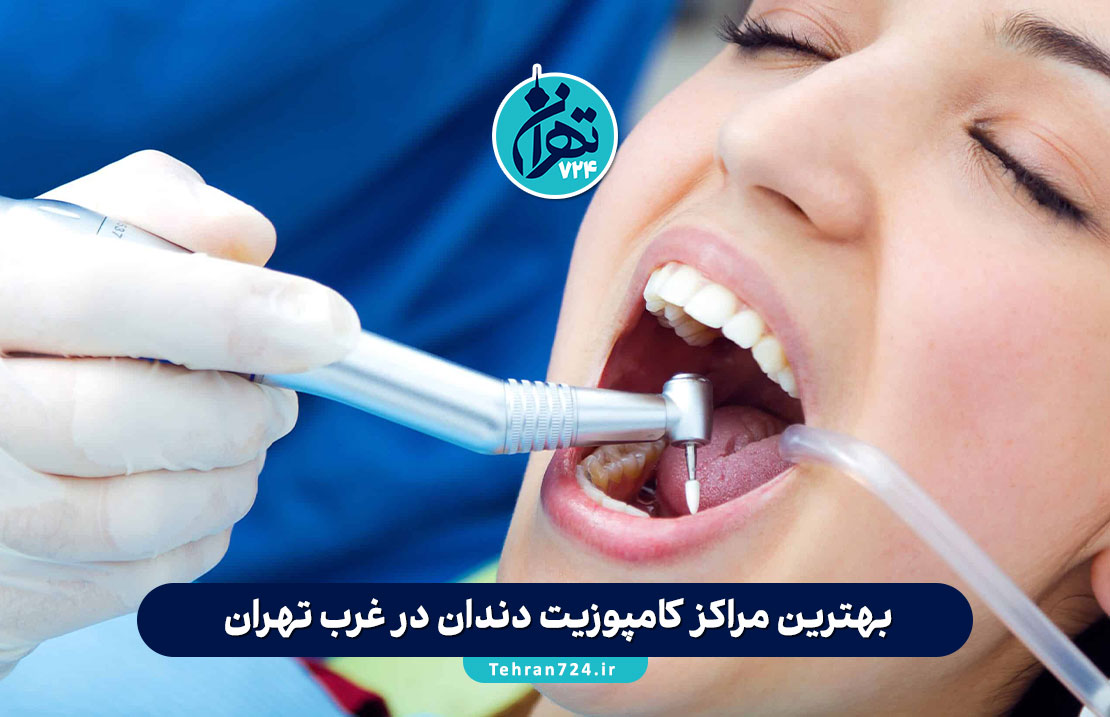 بهترین مراکز کامپوزیت دندان در غرب تهران | معرفی ۵ کلینیک برتر با آدرس و شماره تماس بهترین مراکز کامپوزیت دندان در غرب تهران | معرفی ۵ کلینیک برتر با آدرس و شماره تماس