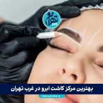 بهترین مرکز کاشت ابرو در غرب تهران | معرفی 8 کلینیک برتر با مشاوره و آدرس کامل