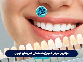 بهترین مرکز کامپوزیت دندان شریعتی تهران | معرفی 5 کلینیک برتر با آدرس و شماره تماس