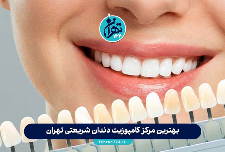 بهترین مرکز کامپوزیت دندان شریعتی تهران | معرفی 5 کلینیک برتر با آدرس و شماره تماس بهترین مرکز کامپوزیت دندان شریعتی تهران | معرفی 5 کلینیک برتر با آدرس و شماره تماس