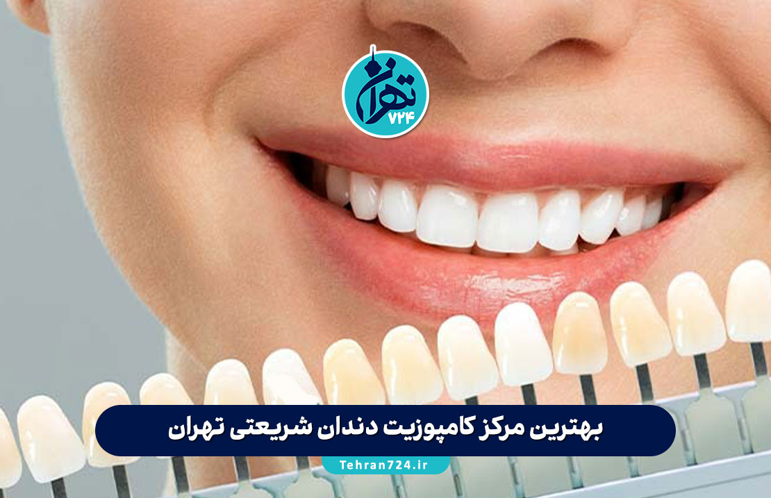 بهترین مرکز کامپوزیت دندان شریعتی تهران | معرفی 5 کلینیک برتر با آدرس و شماره تماس بهترین مرکز کامپوزیت دندان شریعتی تهران | معرفی 5 کلینیک برتر با آدرس و شماره تماس