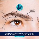 بهترین کلینیک‌ کاشت ابرو در تهران 1405 | معرفی 9 مرکز برتر با شماره تماس و آدرس