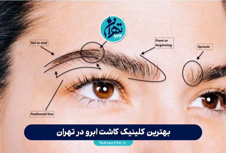 بهترین کلینیک‌ کاشت ابرو در تهران 1405 | معرفی 9 مرکز برتر با شماره تماس و آدرس