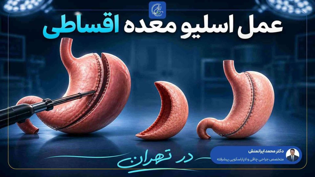 آیا جراحی اسلیو معده پرخطر است؟ دکتر محمد ایرانمنش پاسخ می دهد عمل اسلیو قسطی